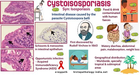 Pathology Of Isosporiasis Cystoisosporiasis Dr Sampurna Roy Md