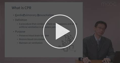 5 6 Ecpr Extracorporeal Cardiopulmonary Resuscitation W5