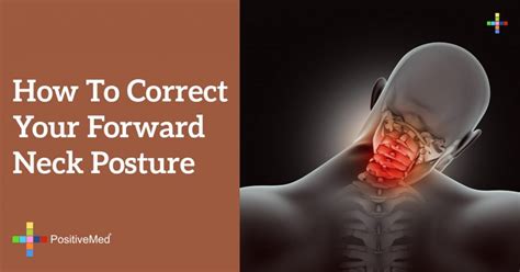 How To Correct Your Forward Neck Posture Positivemed