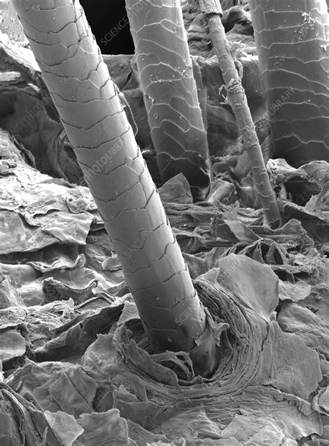 Human Hair Under Electron Microscope