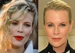 Kim Basinger before and after plastic surgery 6 – Celebrity plastic ...