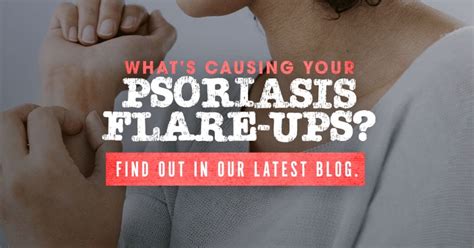 Psoriasis Triggers That Cause Flare Ups Ic Research Tennessee