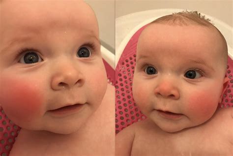 This Is What Teething Looks Like Pictures Taken One Day Apart Rdaddit