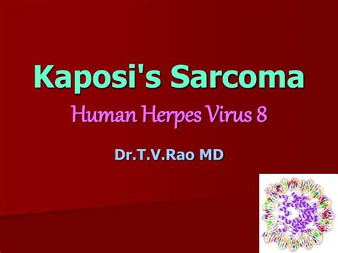 Ppt Kaposis Sarcoma Powerpoint Presentation Free Download Id5841