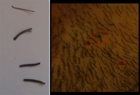 Is In Normal To Have Some Rogue Beard Hairs That Are 6 Times Fatter