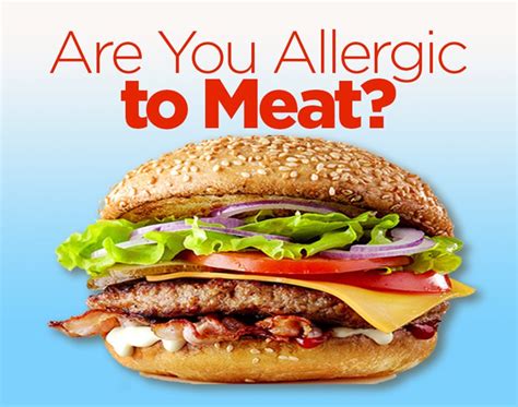Meat Allergy Its More Common Than You Think Lee Health