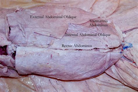 Diagram with labels of major structures: Cat Muscles Labeled | Specimens : Cat : Thorax , Abdomen ...