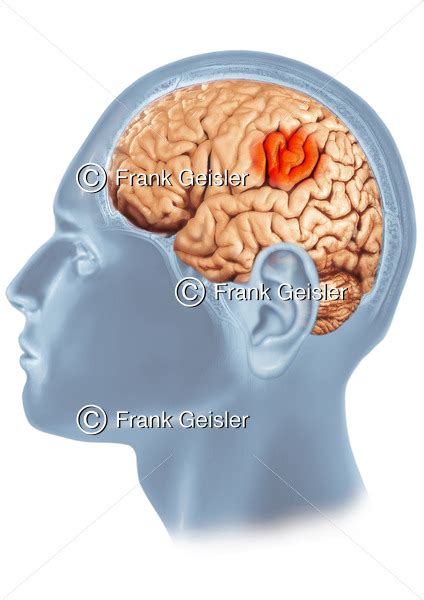 Epilepsie Gehirn Mit Fokalen Epileptischen Anfall Medical Pictures