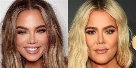 Trending Global Media 🤩😣😞 Kuwtk What Khloe Kardashian Looks Like Before And After The Operation