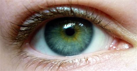 Heterochromia manifests itself in one of three forms; Central Heterochromia - Reasons, Possibility and its Types ...