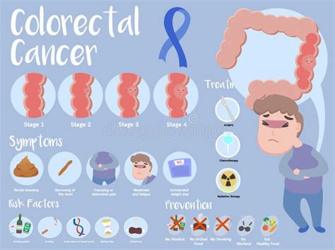 Colorectal Cancer Infographic Stock Vector Illustration Of Cancer
