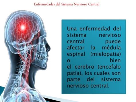 Clase 3 Enfermedades Y Afecciones Del Sistema Nervioso