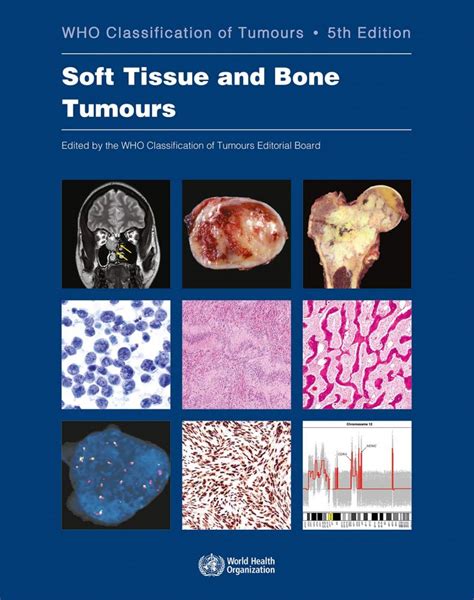 Livraria E Editora Livromed Paulista Soft Tissue And Bone Tumours Who
