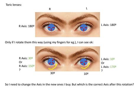 very quick question about toric contact lense axis optometry