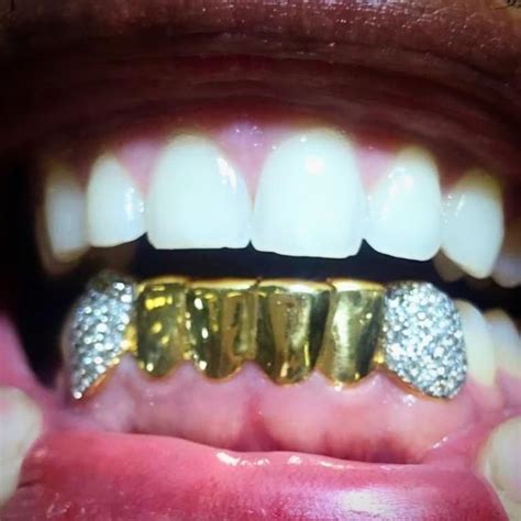Custom 6 Or 8 Teeth Solid Gold Grillz With Diamond Fangs Gold Grillz