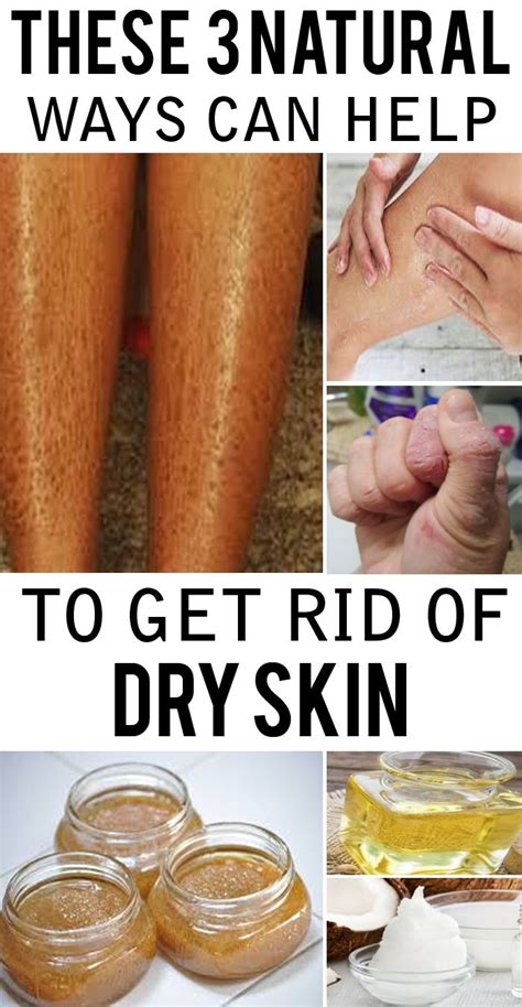 How To Remove Dry Skin On Legs And Hands At Home Dry Skin Patches