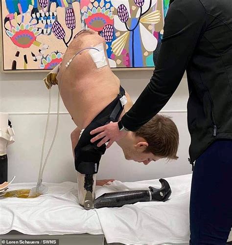 Teen Has The Entire Bottom Half Of His Body Amputated In
