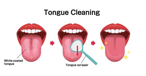 Black Hairy Tongue Causes Symptoms And Treatments Bitvae Electric Toothbrush