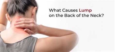 What Causes Lump On The Back Of Neck 5 Effective Home Remedies