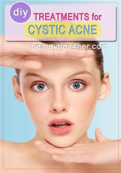 Cystic Acne Diy Treatments That Provide Results Look Good Naturally