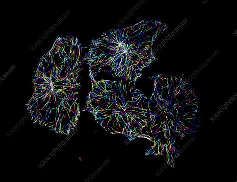 Hela Cells Light Micrograph Stock Image C0200570 Science Photo