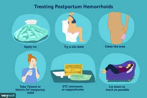 Hemorroides Despu S De Dar A Luz Medicina B Sica