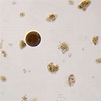 Entamoeba coli Trophozoites, smear Microscope Slide | Carolina.com