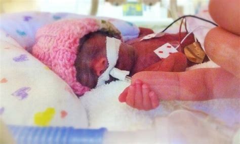 24 Week Premature Babys Story Of Survival At 24 Weeks Kidspot