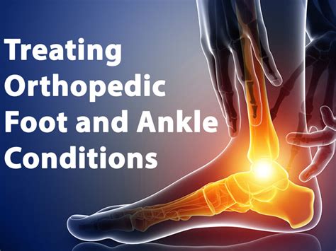 Treating Orthopedic Foot And Ankle Conditions Foot Ankle Ortho Dr