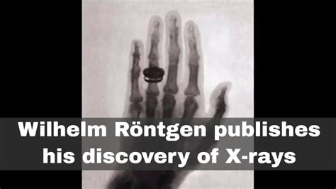 28th December 1895 Wilhelm Röntgen Publishes His Discovery Of X Rays Youtube