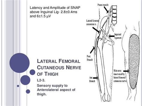 Right Lateral Femoral Cutaneous Nerve