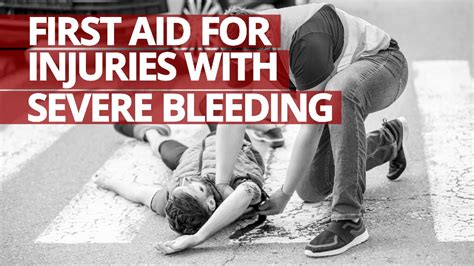 First Aid For Injuries With Severe Bleeding Lifesaver Youtube