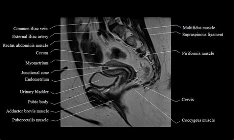 Human stomach internal organ stock photos and pictures. MRI female pelvis anatomy | free MRI sagittal cross sectional anatomy of female pelvis