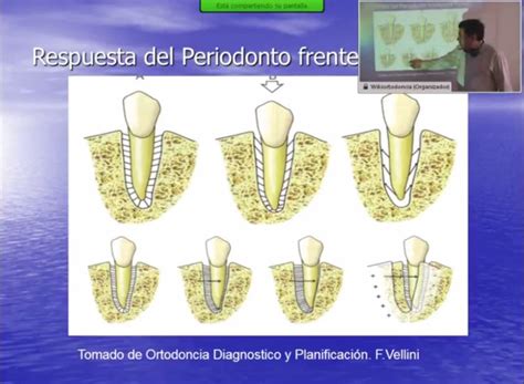 Biologia Del Movimiento Dentario I2016 Wikiortodoncia