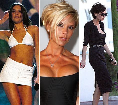 Victoria Beckhams Plastic Surgery In Full After Claiming Shes Never