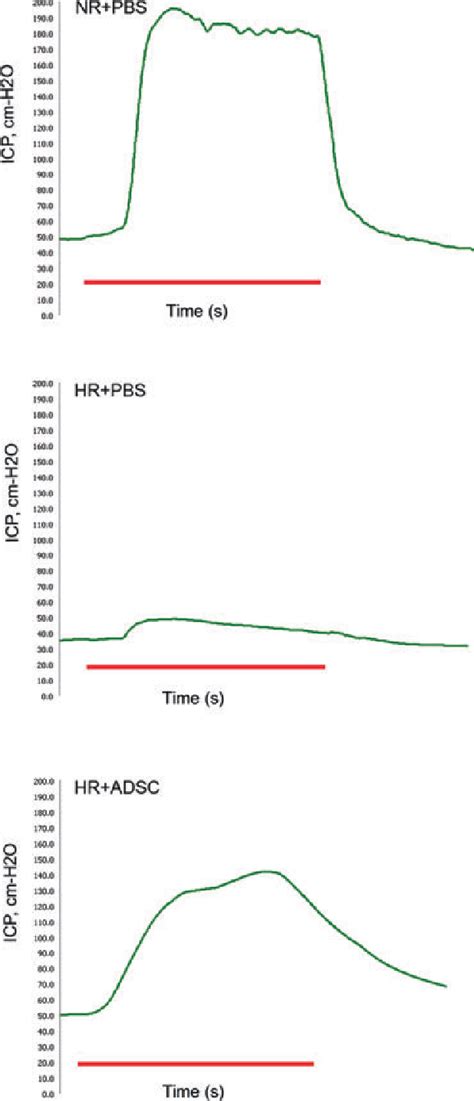 Figure From The Effect Of Intracavernous Injection Of Adipose Tissue Derived Stem Cells On