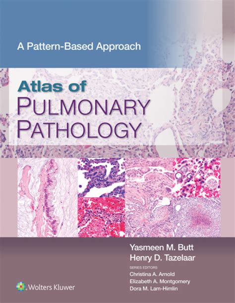 Atlas Of Pulmonary Pathology Ebook En Laleo