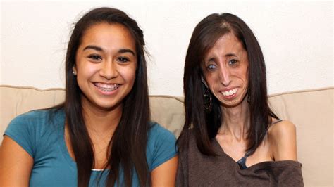 Worlds Thinnest Woman Lizzie Velasquez Who Has A Medical Condition