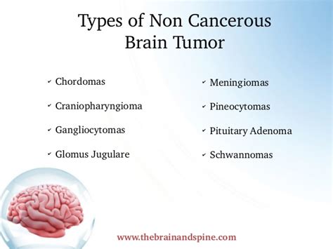 Doctors cannot explain why some children and adults develop brain tumors. Get info about types of brain tumors non cancerous. Look ...