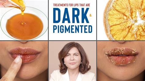 How To Treat Dark Pigmented Lips Dermatologists Advice Youtube