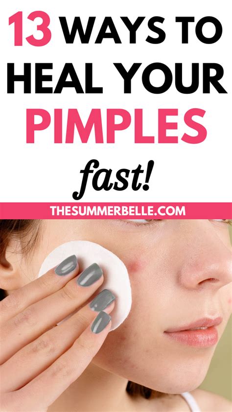 13 Ways To Heal Your Pimple Fast How To Get Rid Of Pimples How To