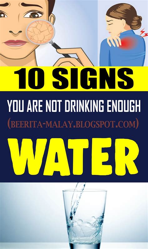 10 Signs You Are Not Drinking Enough Water Health And Wellness