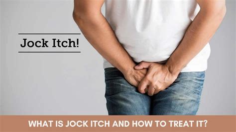 Jock Itch Tinea Cruris Causes Symptoms Diagnosis 45 Off