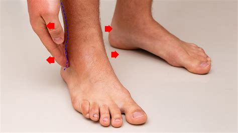 Doctors Explain 6 Things That Cause Swollen Ankles And How To Fix It