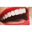 Teeth Whitening DIY Kits Are Dangerous Councils Warn  ITV News