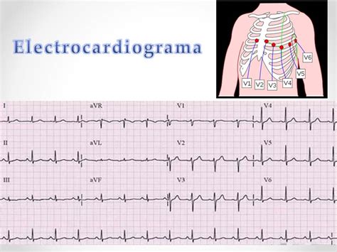 Fisiología Básica Electrocardiograma Normal