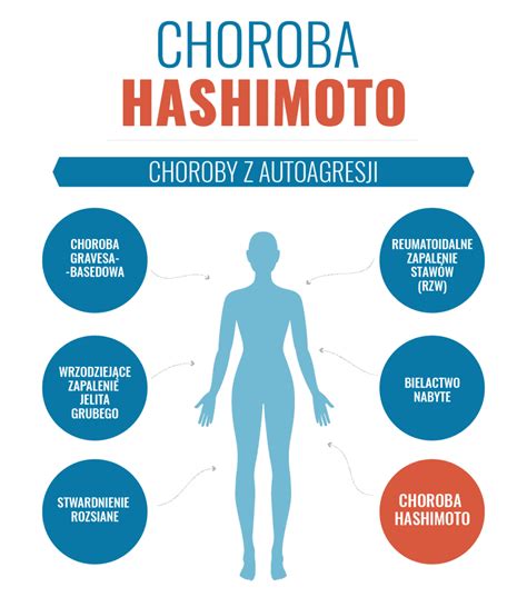 Choroba Hashimoto czyli przewlekłe zapalenie tarczycy Objawy