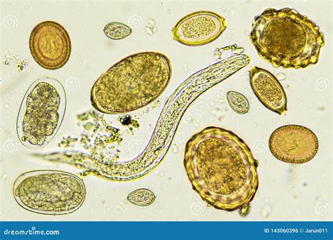 Mixed Of Helminths Or Parasitic Worm In Stool Stock Photo Image Of