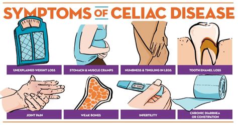 Celiac Disease Vita Pharmed Sa Switzerland