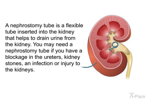 Nephrostomy Tube Care